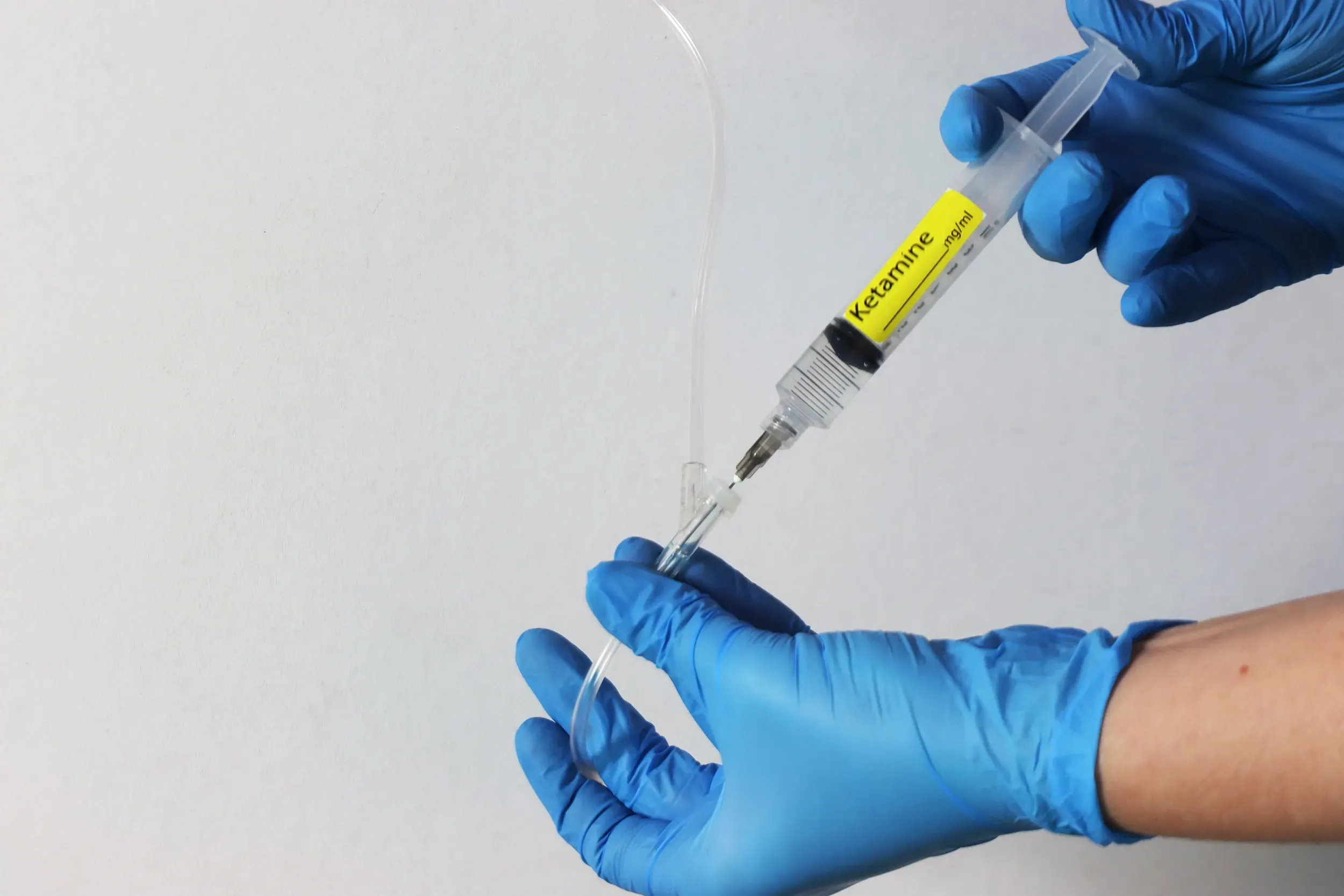 The Science Behind Ketamine as a Therapeutic Agent
